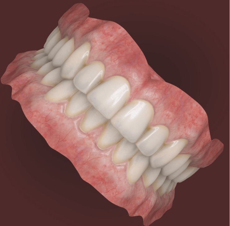 Dentures 3d model by Nikola Dechev
